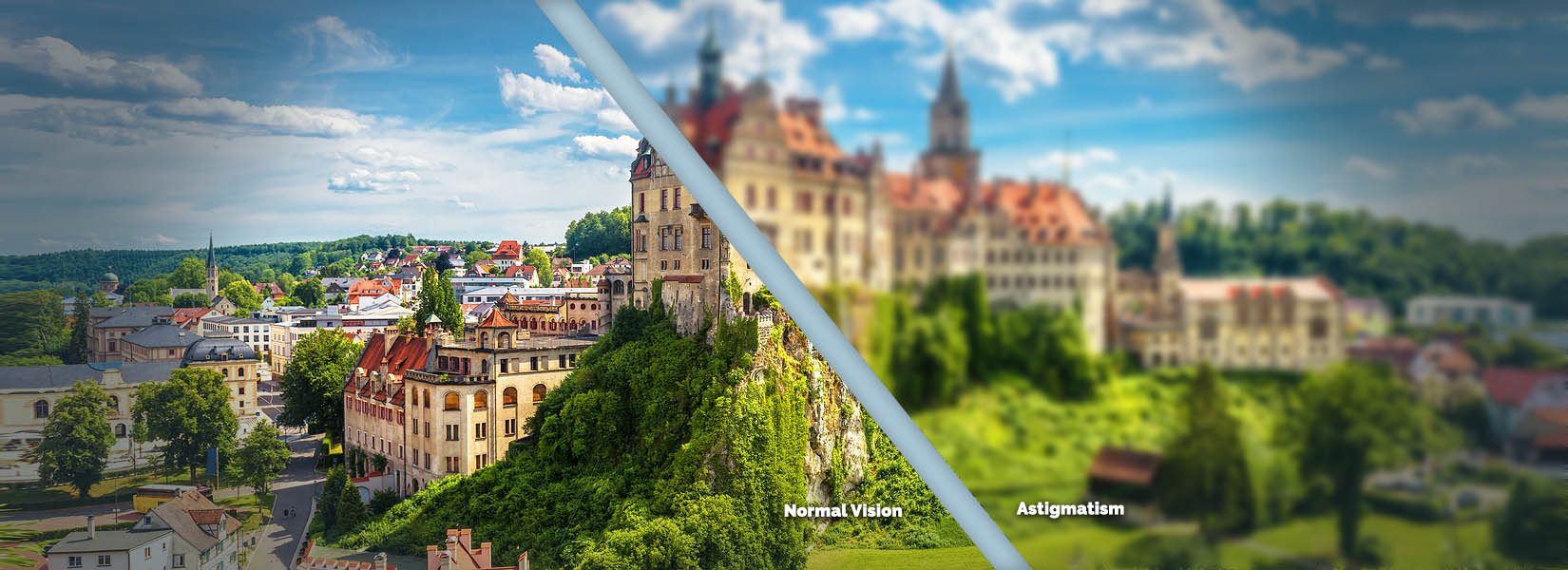 Astigmatism Treatment in Portland