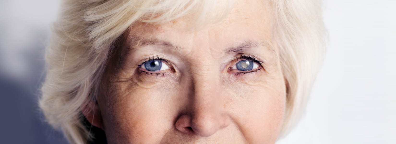 Cataract Surgery in Portland